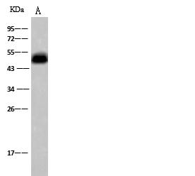 NDRG1 Antibody - Anti-NDRG1 rabbit polyclonal antibody at 1:500 dilution. Lane A: HeLa Whole Cell Lysate. Lysates/proteins at 30 ug per lane. Secondary: Goat Anti-Rabbit IgG (H+L)/HRP at 1/10000 dilution. Developed using the ECL technique. Performed under reducing conditions. Predicted band size: 43 kDa. Observed band size: 46 kDa.