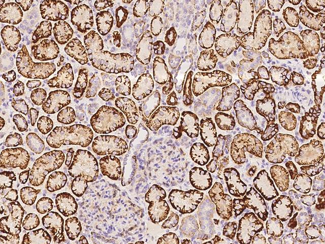 NDRG1 Antibody - Immunochemical staining of human NDRG1 in human kidney with rabbit polyclonal antibody at 1:5000 dilution, formalin-fixed paraffin embedded sections.