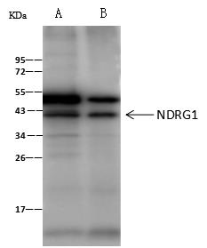 NDRG1 Antibody - NDRG1 was immunoprecipitated using: Lane A: 0.5 mg HeLa Whole Cell Lysate. Lane B: 0.5 mg HepG2 Whole Cell Lysate. 2 uL anti-NDRG1 rabbit polyclonal antibody and 60 ug of Immunomagnetic beads Protein A/G. Primary antibody: Anti-NDRG1 rabbit polyclonal antibody, at 1:100 dilution. Secondary antibody: Clean-Blot IP Detection Reagent (HRP) at 1:1000 dilution. Developed using the ECL technique. Performed under reducing conditions. Predicted band size: 43 kDa. Observed band size: 43 kDa.