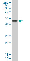NDRG2 Antibody - NDRG2 monoclonal antibody (M06), clone 1D12. Western blot of NDRG2 expression in A-431.