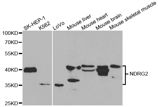NDRG2 Antibody - Western blot analysis of extracts of various cell lines.