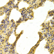 NDRG2 Antibody - Immunohistochemistry of paraffin-embedded rat kidney tissue.