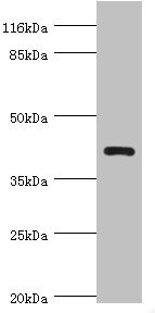 NDRG2 Antibody - Western blot All Lanes:NDRG2 antibody at 4.93ug/ml+A431 whole cell lysate Secondary Goat polyclonal to rabbit at 1/10000 dilution Predicted band size: 41,40,37,38 kDa Observed band size: 41 kDa