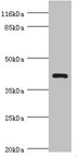 NDRG2 Antibody - Western blot All Lanes:NDRG2 antibody at 4.93ug/ml+A431 whole cell lysate Secondary Goat polyclonal to rabbit at 1/10000 dilution Predicted band size: 41,40,37,38 kDa Observed band size: 41 kDa