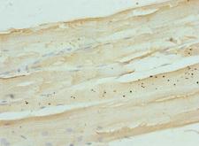 NDRG2 Antibody - Immunohistochemistry of paraffin-embedded human skeletal muscle tissue at dilution 1:100