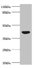 NDRG2 Antibody - Western blot All Lanes:NDRG2 antibody at 4.02ug/ml+mouse kidney tissue Secondary Goat polyclonal to rabbit at 1/10000 dilution Predicted band size: 41,40,37,38 kDa Observed band size: 41 kDa