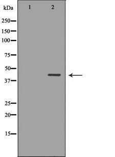 NDRG2 Antibody - Western blot analysis of HepG2 whole cells lysates using NDRG2 antibody. The lane on the left is treated with the antigen-specific peptide.