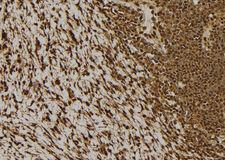 NDRG2 Antibody - 1:100 staining human gastric tissue by IHC-P. The sample was formaldehyde fixed and a heat mediated antigen retrieval step in citrate buffer was performed. The sample was then blocked and incubated with the antibody for 1.5 hours at 22°C. An HRP conjugated goat anti-rabbit antibody was used as the secondary.