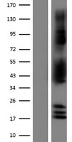 NDRG2 Protein - Western validation with an anti-DDK antibody * L: Control HEK293 lysate R: Over-expression lysate