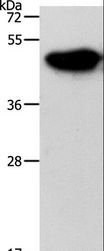 NDRG3 Antibody - Western blot analysis of Mouse brain tissue, using NDRG3 Polyclonal Antibody at dilution of 1:1050.