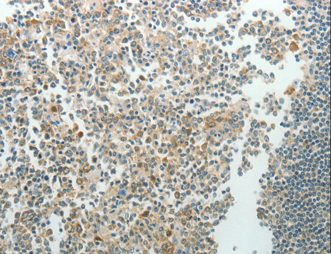 NDRG3 Antibody - Immunohistochemistry of paraffin-embedded Human tonsil using NDRG3 Polyclonal Antibody at dilution of 1:70.