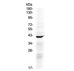 NDRG3 Antibody - Western blot testing of human COLO320 cell lysate with NDRG3 antibody at 0.5ug/ml. Predicted molecular weight ~41 kDa.