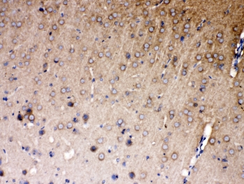 NDRG3 Antibody - IHC testing of FFPE rat brain tissue with NDRG3 antibody at 1ug/ml. Required HIER: steam section in pH6 citrate buffer for 20 min and allow to cool prior to testing.