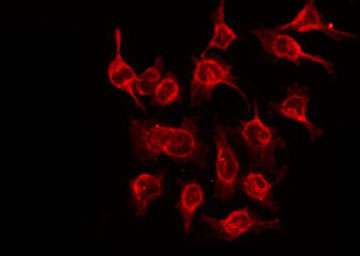 NDRG3 Antibody - Staining HeLa cells by IF/ICC. The samples were fixed with PFA and permeabilized in 0.1% Triton X-100, then blocked in 10% serum for 45 min at 25°C. The primary antibody was diluted at 1:200 and incubated with the sample for 1 hour at 37°C. An Alexa Fluor 594 conjugated goat anti-rabbit IgG (H+L) Ab, diluted at 1/600, was used as the secondary antibody.