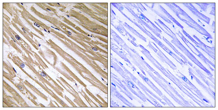 NDRG4 Antibody - Immunohistochemistry analysis of paraffin-embedded human heart tissue, using NDRG4 Antibody. The picture on the right is blocked with the synthesized peptide.