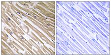 NDRG4 Antibody - Immunohistochemistry analysis of paraffin-embedded human heart tissue, using NDRG4 Antibody. The picture on the right is blocked with the synthesized peptide.