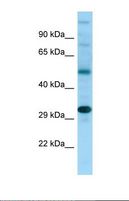 NDRG4 Antibody - Western blot of Human Fetal Liver. NDRG4 antibody dilution 1.0 ug/ml.  This image was taken for the unconjugated form of this product. Other forms have not been tested.