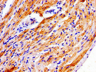 NDRG4 Antibody - Immunohistochemistry image of paraffin-embedded human heart tissue at a dilution of 1:100