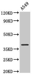 NDRG4 Antibody - Positive Western Blot detected in A549 whole cell lysate. All lanes: NDRG4 antibody at 2 µg/ml Secondary Goat polyclonal to rabbit IgG at 1/50000 dilution. Predicted band size: 39, 38, 41, 43, 40 KDa. Observed band size: 39 KDa