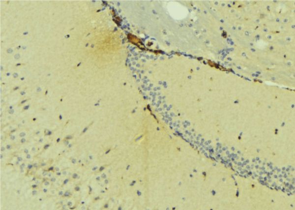 NDRG4 Antibody - 1:100 staining mouse brain tissue by IHC-P. The sample was formaldehyde fixed and a heat mediated antigen retrieval step in citrate buffer was performed. The sample was then blocked and incubated with the antibody for 1.5 hours at 22°C. An HRP conjugated goat anti-rabbit antibody was used as the secondary.