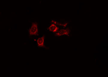 NDRG4 Antibody - Staining HT29 cells by IF/ICC. The samples were fixed with PFA and permeabilized in 0.1% Triton X-100, then blocked in 10% serum for 45 min at 25°C. The primary antibody was diluted at 1:200 and incubated with the sample for 1 hour at 37°C. An Alexa Fluor 594 conjugated goat anti-rabbit IgG (H+L) antibody, diluted at 1/600, was used as secondary antibody.