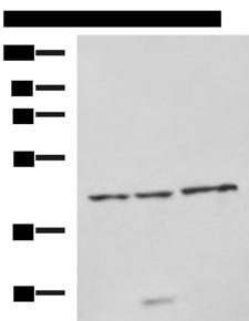 NDRG4 Antibody - Western blot analysis of RAW264.7 cell Rat brain tissue and Mouse brain tissue lysates  using NDRG4 Polyclonal Antibody at dilution of 1:650