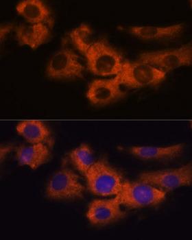 NDRG4 Antibody - Immunofluorescence analysis of C6 cells using NDRG4 Polyclonal Antibody at dilution of 1:100.Blue: DAPI for nuclear staining.