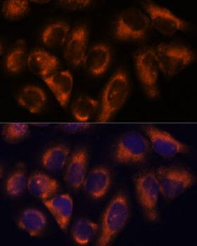 NDRG4 Antibody - Immunofluorescence analysis of HeLa cells using NDRG4 Polyclonal Antibody at dilution of 1:100.Blue: DAPI for nuclear staining.