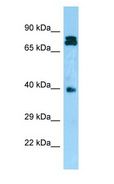 NDRG4 Antibody - NDRG4 antibody Western Blot of PANC1.  This image was taken for the unconjugated form of this product. Other forms have not been tested.
