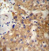 NDST1 Antibody - NDST1 Antibody immunohistochemistry of formalin-fixed and paraffin-embedded human liver tissue followed by peroxidase-conjugated secondary antibody and DAB staining.