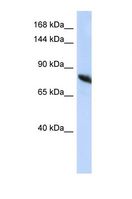 NDST2 Antibody - Western blot of Human HepG2. NDST2 antibody dilution 1.0 ug/ml.  This image was taken for the unconjugated form of this product. Other forms have not been tested.