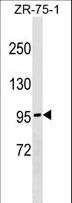 NDST4 Antibody - NDST4 Antibody western blot of ZR-75-1 cell line lysates (35 ug/lane). The NDST4 antibody detected the NDST4 protein (arrow).
