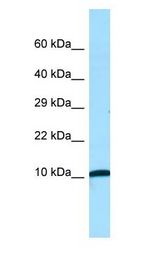 NDUFA1 Antibody - NDUFA1 antibody Western Blot of Fetal kidney.  This image was taken for the unconjugated form of this product. Other forms have not been tested.