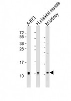 NDUFA1 Antibody - All lanes: Anti-NDUFA1 Antibody (Center) at 1:2000 dilution. Lane 1: A-673 whole cell lysate. Lane 2: human skeletal muscle lysate. Lane 3: mouse kidney lysate Lysates/proteins at 20 ug per lane. Secondary Goat Anti-Rabbit IgG, (H+L), Peroxidase conjugated at 1:10000 dilution. Predicted band size: 8 kDa. Blocking/Dilution buffer: 5% NFDM/TBST.