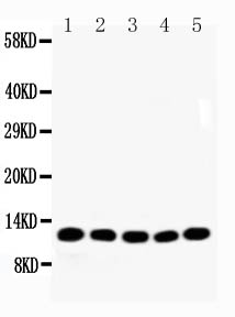 NDUFA1 Antibody - WB of NDUFA1 antibody. All lanes: Anti-NDUFA1 at 0.5ug/ml. Lane 1: Rat Cardiac Muscle Tissue Lysate at 40ug. Lane 2: Rat Liver Tissue Lysate at 40ug. Lane 3: Rat Kidney Tissue Lysate at 40ug. Lane 4: Rat Brain Tissue Lysate at 40ug. Lane 5: HT1080 Whole Cell Lysate at 40ug. Predicted bind size: 8KD. Observed bind size: 12KD.