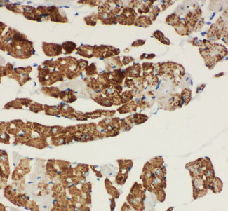 NDUFA1 Antibody - NDUFA1 antibody. IHC(P): Rat Cardiac Muscle Tissue.