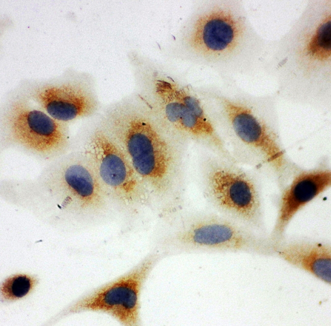 NDUFA1 Antibody - ICC analysis of NDUFA1 using anti-NDUFA1 antibody. NDUFA1 was detected in immunocytochemical section of A549 cell. Heat mediated antigen retrieval was performed in citrate buffer (pH6, epitope retrieval solution) for 20 mins. The tissue section was blocked with 10% goat serum. The tissue section was then incubated with 1µg/ml rabbit anti-NDUFA1 Antibody overnight at 4°C. Biotinylated goat anti-rabbit IgG was used as secondary antibody and incubated for 30 minutes at 37°C. The tissue section was developed using Strepavidin-Biotin-Complex (SABC) with DAB as the chromogen.