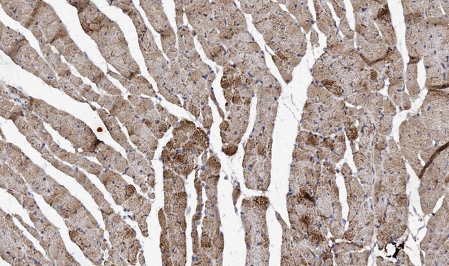 NDUFA1 Antibody - IHC analysis of NDUFA1 using anti-NDUFA1 antibody. NDUFA1 was detected in paraffin-embedded section of mouse skeletal muscle tissues. Heat mediated antigen retrieval was performed in citrate buffer (pH6, epitope retrieval solution) for 20 mins. The tissue section was blocked with 10% goat serum. The tissue section was then incubated with 1µg/ml rabbit anti-NDUFA1 Antibody overnight at 4°C. Biotinylated goat anti-rabbit IgG was used as secondary antibody and incubated for 30 minutes at 37°C. The tissue section was developed using Strepavidin-Biotin-Complex (SABC) with DAB as the chromogen.