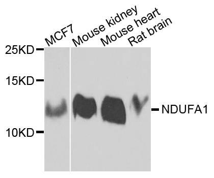 NDUFA1 Antibody - Western blot analysis of extracts of various cells.