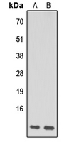 NDUFA1 Antibody - Western blot analysis of NDUFA1 expression in HeLa (A); Raw264.7 (B) whole cell lysates.