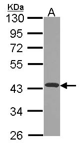 NDUFA10 Antibody - Sample (30 ug of whole cell lysate). A: JurKat. 10% SDS PAGE. NDUFA10 antibody diluted at 1:1000.