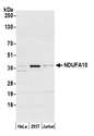 NDUFA10 Antibody - Detection of human NDUFA10 by western blot. Samples: Whole cell lysate (50 µg) from HeLa, HEK293T, and Jurkat cells prepared using NETN lysis buffer. Antibody: Affinity purified rabbit anti-NDUFA10 antibody used for WB at 0.4 µg/ml. Detection: Chemiluminescence with an exposure time of 30 seconds.