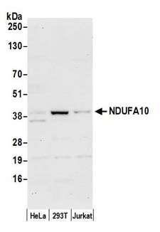 NDUFA10 Antibody - Detection of human NDUFA10 by western blot. Samples: Whole cell lysate (50 µg) from HeLa, HEK293T, and Jurkat cells prepared using NETN lysis buffer. Antibody: Affinity purified rabbit anti-NDUFA10 antibody used for WB at 0.4 µg/ml. Detection: Chemiluminescence with an exposure time of 30 seconds.