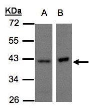 NDUFA10 Antibody - Sample (30 ug of whole cell lysate). A: H1299, B: Raji. 10% SDS PAGE. NDUFA10 antibody diluted at 1:500