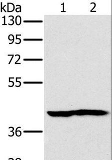 NDUFA10 Antibody - Western blot analysis of Mouse heart and kidney tissue, using NDUFA10 Polyclonal Antibody at dilution of 1:450.