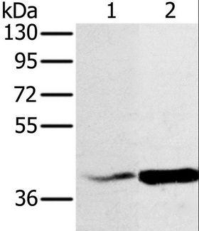 NDUFA10 Antibody - Western blot analysis of HeLa and A549 cell, using NDUFA10 Polyclonal Antibody at dilution of 1:500.