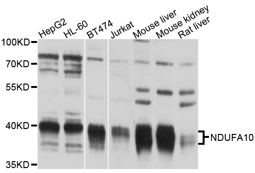 NDUFA10 Antibody - Western blot analysis of extracts of various cell lines, using NDUFA10 antibody at 1:1000 dilution. The secondary antibody used was an HRP Goat Anti-Rabbit IgG (H+L) at 1:10000 dilution. Lysates were loaded 25ug per lane and 3% nonfat dry milk in TBST was used for blocking. An ECL Kit was used for detection and the exposure time was 30s.