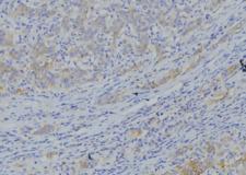 NDUFA10 Antibody - 1:100 staining human gastric tissue by IHC-P. The sample was formaldehyde fixed and a heat mediated antigen retrieval step in citrate buffer was performed. The sample was then blocked and incubated with the antibody for 1.5 hours at 22°C. An HRP conjugated goat anti-rabbit antibody was used as the secondary.