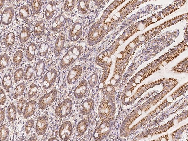 NDUFA10 Antibody - Immunochemical staining of human NDUFA10 in human small intestine with rabbit polyclonal antibody at 1:500 dilution, formalin-fixed paraffin embedded sections.