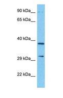 NDUFA10 Antibody - Western blot of NDUAA Antibody with human 721_B Whole Cell lysate.  This image was taken for the unconjugated form of this product. Other forms have not been tested.